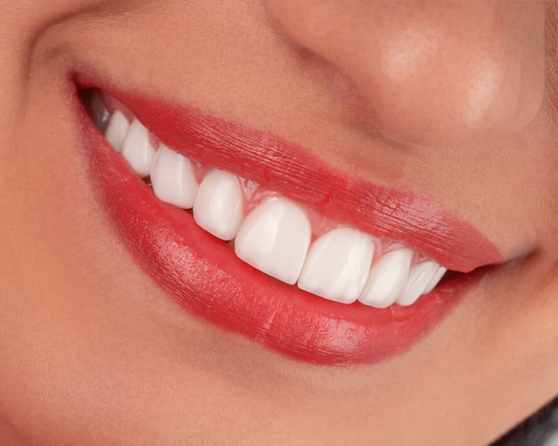 Depois — Transformação dental — antes e depois