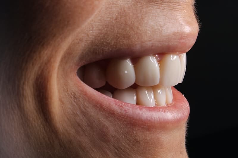 Depois — Transformação dental — antes e depois